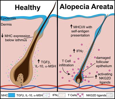 An overview of JAK/STAT pathways and JAK inhibition in alopecia areata